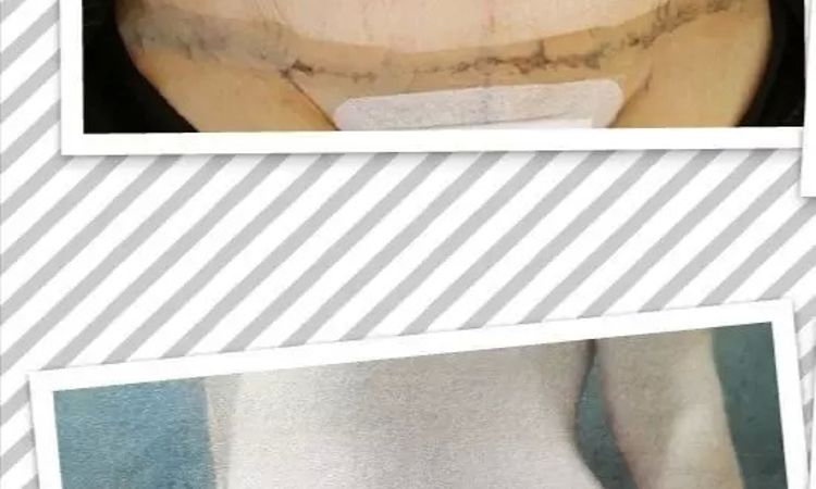 117072