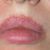Wunderschönes Direktes Lippenlift