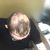 Reibungslose Haartransplantation bei Dr. Cinik
