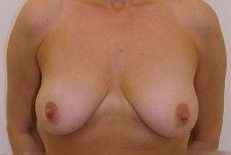 115518