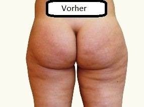 26467