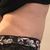 Dünne Taille und flacher Bauch nach Bauchstraffung mit Fettabsaugung