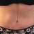 Dünne Taille und flacher Bauch nach Bauchstraffung mit Fettabsaugung