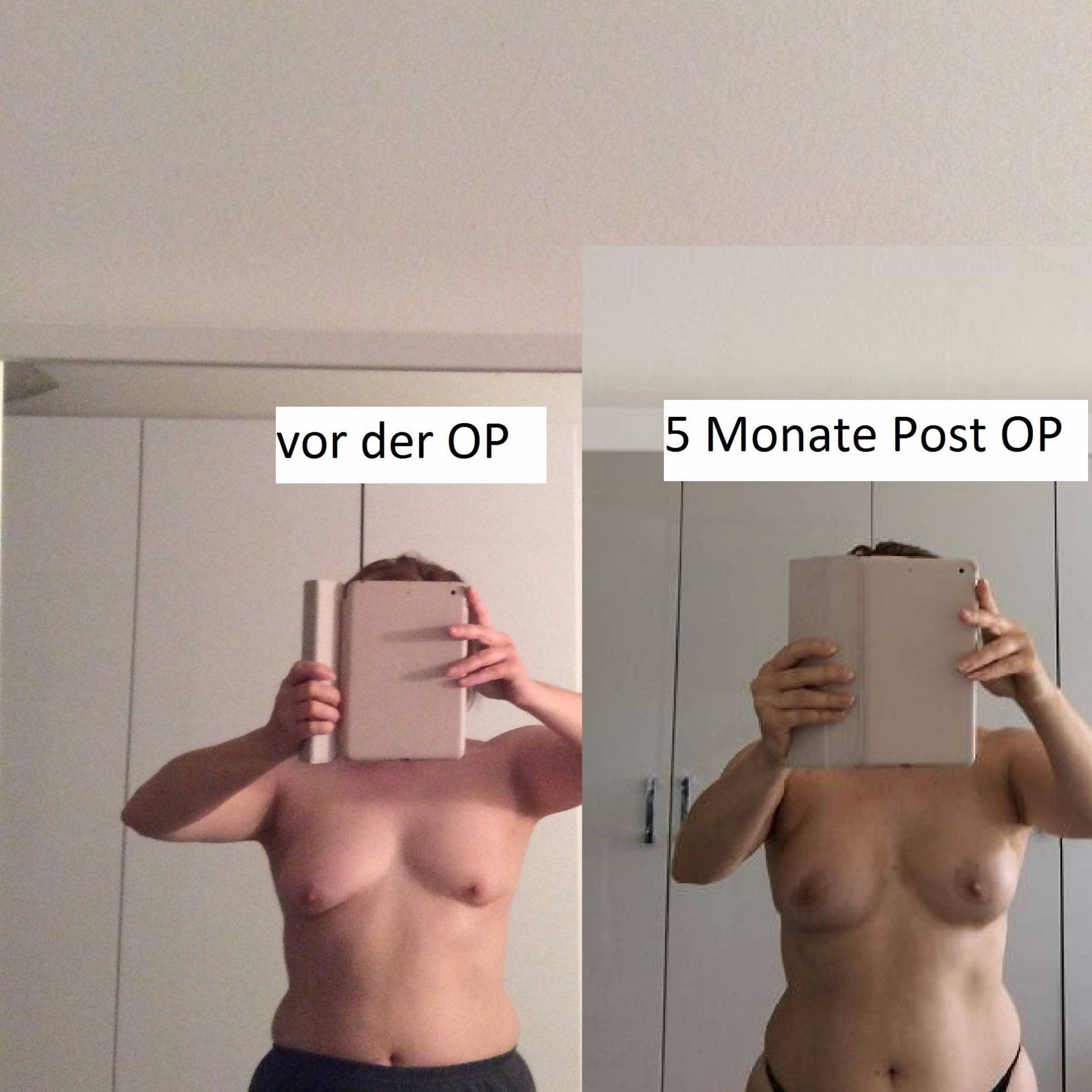 26429