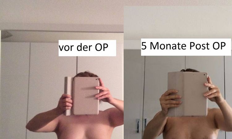 26429
