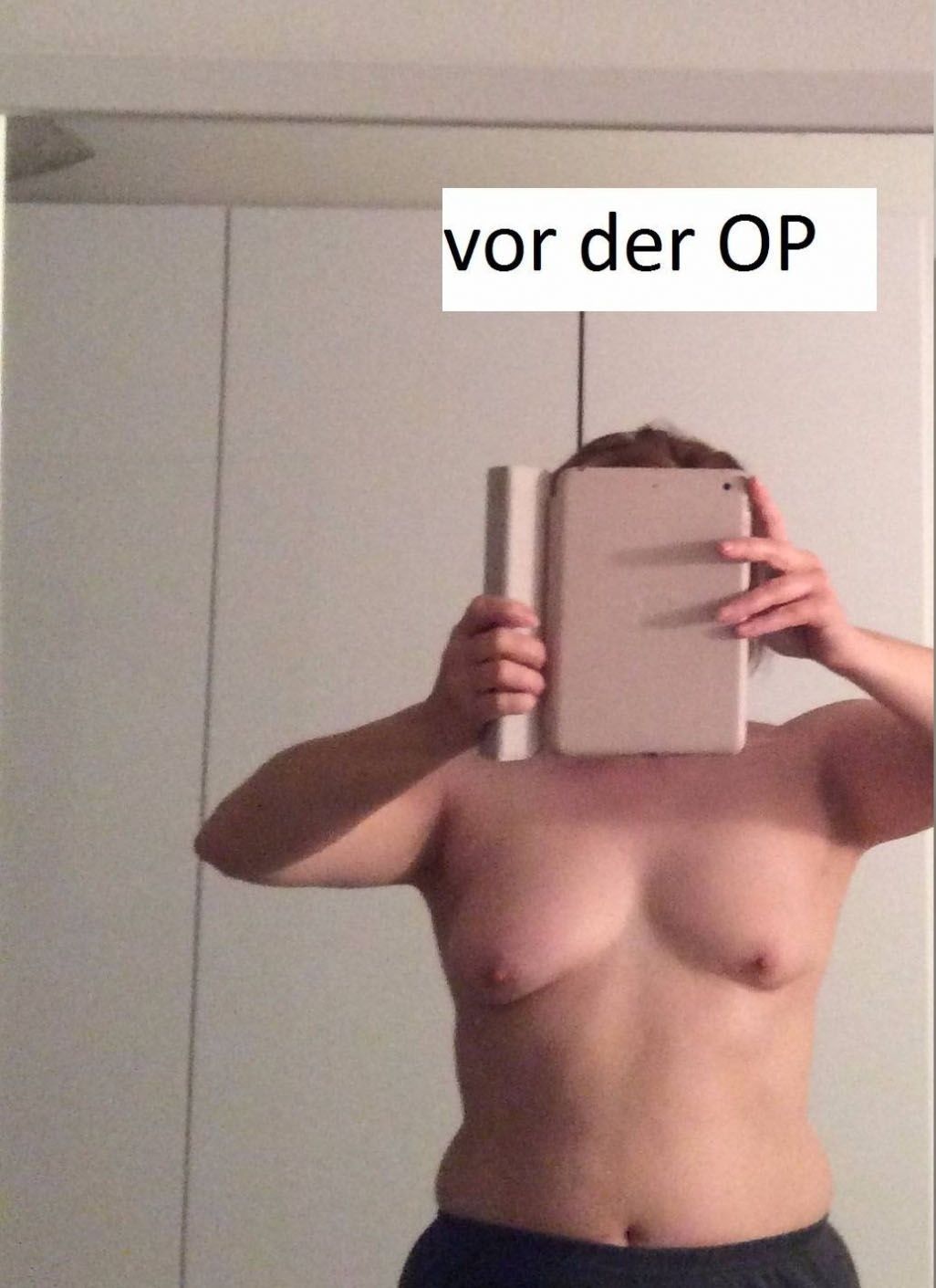 26431