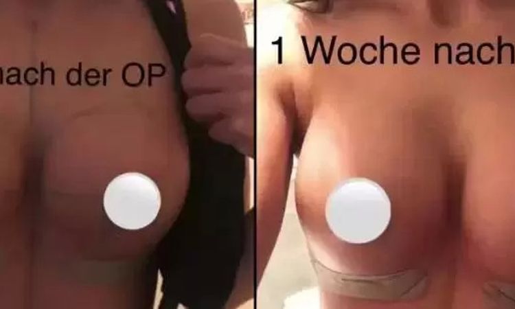 27125