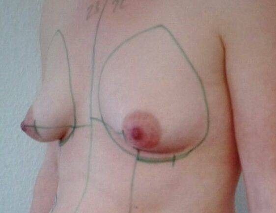 26438