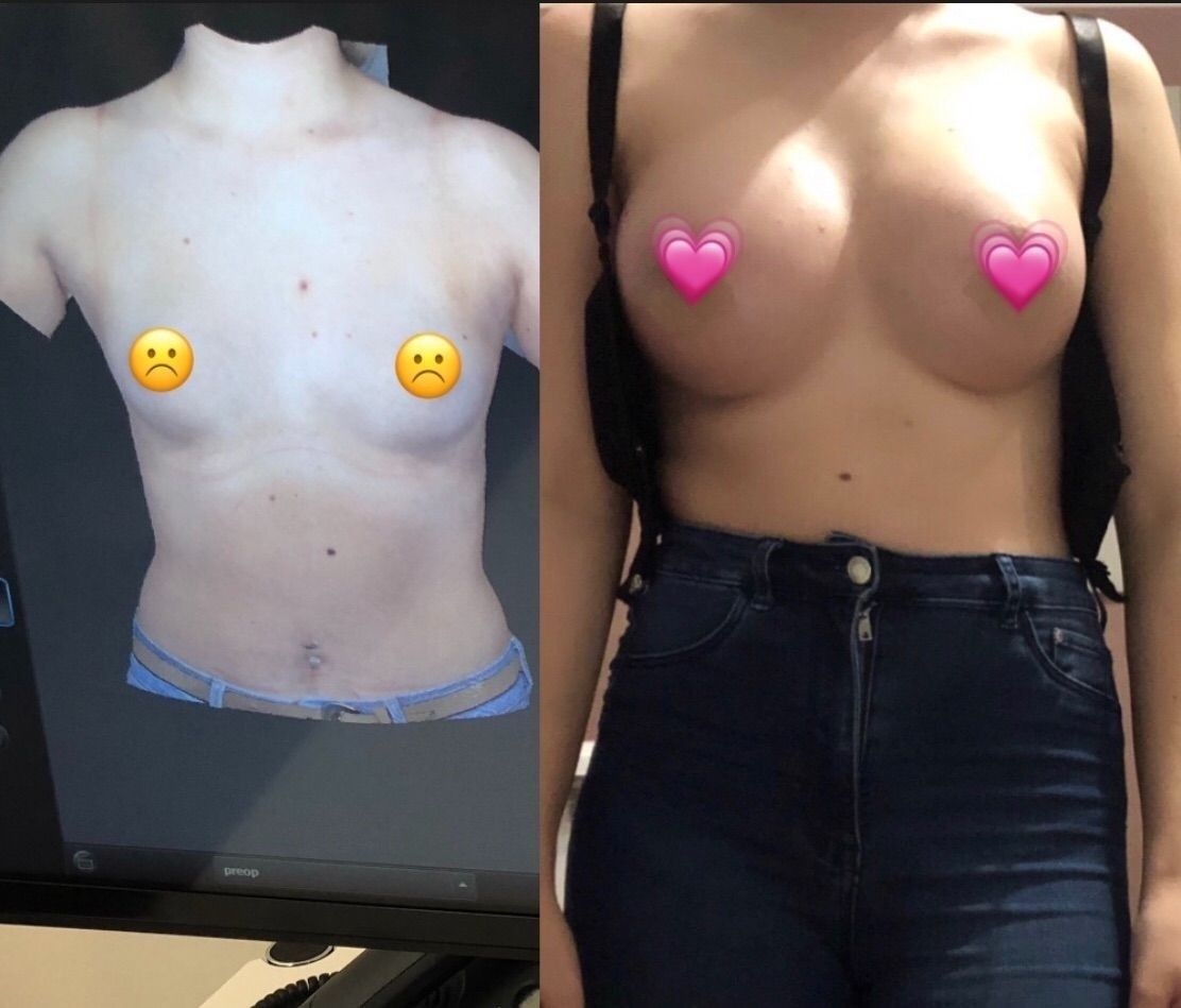 27040