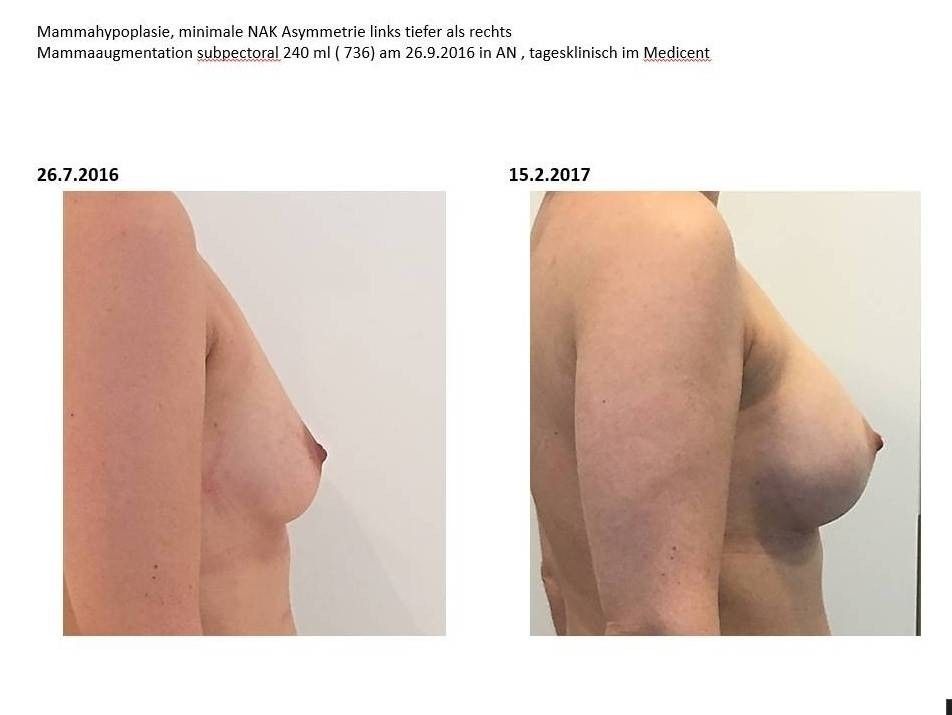 26405