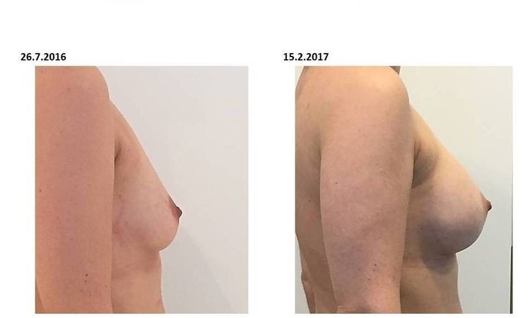 26405