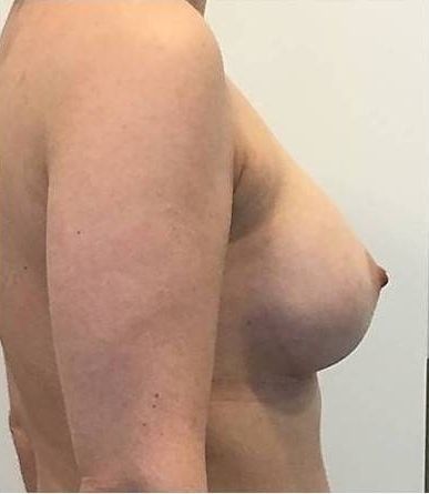 26408
