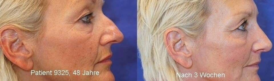 26640