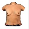 Motiva oder Nagor Implantate?