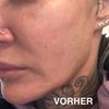 nach Facelift kein Unterschied