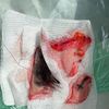 nach Facelift kein Unterschied