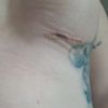 Eine Brust komplett anders als die andere