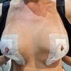 Komisches Gefühl in der einen Brust