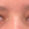 Asymmetrische Augen und Brauen