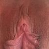 4 Tage nach OP, unsicher mit Ergebnis