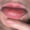 Lippen Revolax Angst Sorge