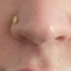 Nasenkorrektur ohne OP, kann ich Nasenform mit Kristallkrotizon verschmälern?