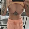 Motiva Implantate abgesackt?