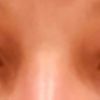 Extrem unterschiedliche Augen