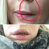 Auflösung von Uma Jeunesse an den Lippen durch Hylase