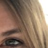 Oberlidstraffung, Botox oder Kanthoplastik?