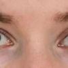 Auffällig assymetrische Augen korrigieren