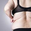 Fettpölsterchen Ade - Welche Körperstellen sind besonders gefragt bei der Fettabsaugung?