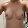 Reine Einbildung oder asymmetrisch?
