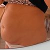Reicht Liposuction oder ist Bauchdeckenstraffung effektiver?