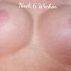 Hatte jemand schonmal ein Double bubble??