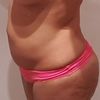 Body Tite XL oder normale Fettabsaugung in Tschechien