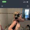 Unsymmetrische Brust, könnte das Kapselfibrose sein?