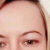 Augenlidstraffung und /oder Brauenlifting, wie öffne ich meine Augen optisch?