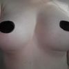 Habe ich ein Bottoming out?
