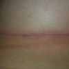 71636