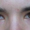 Asymmetrische Augenbraue & hängendes Oberlid - 25353