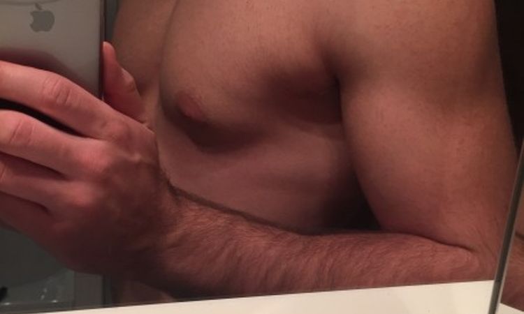 Sehr weiche Brustwarzen nach Verkleinerung - 25804
