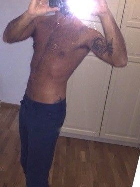 Ist Kompressionsmieder notwendig bei Fettabsaugung am Bauch/Rücken/Brust/Flanken? - 25816