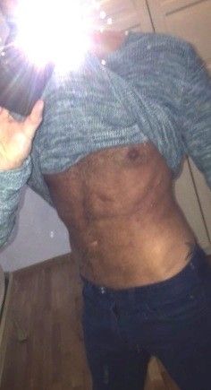 Ist Kompressionsmieder notwendig bei Fettabsaugung am Bauch/Rücken/Brust/Flanken? - 25818