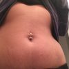 Bodytite am Bauch