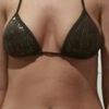 Neue Implantate Jahre nach Brustvergrößerung - 25899