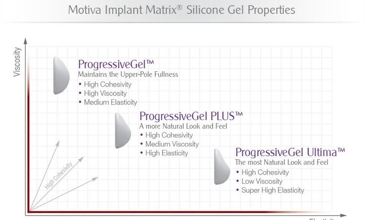 Welche Oberfläche haben Motiva Implantate? - 26035