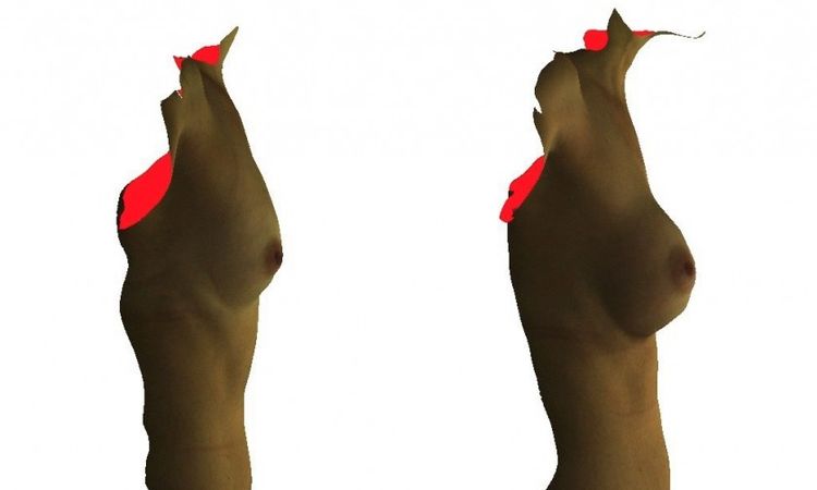 Natürliche Form der Brust durch Motiva Ergonomics - 26239