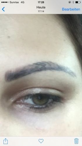 Chirurgische Entfernung des Permanent Make ups