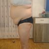 Po-Vergrößserung bei hängendem Bauch